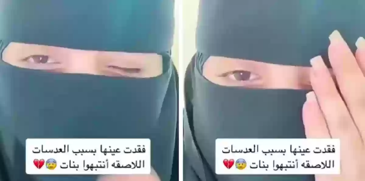 فقدت عينها بسبب العدسات اللاصقة!